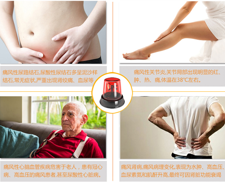 優(yōu)速型血糖尿酸測(cè)試儀家用測(cè)尿酸 尿酸儀