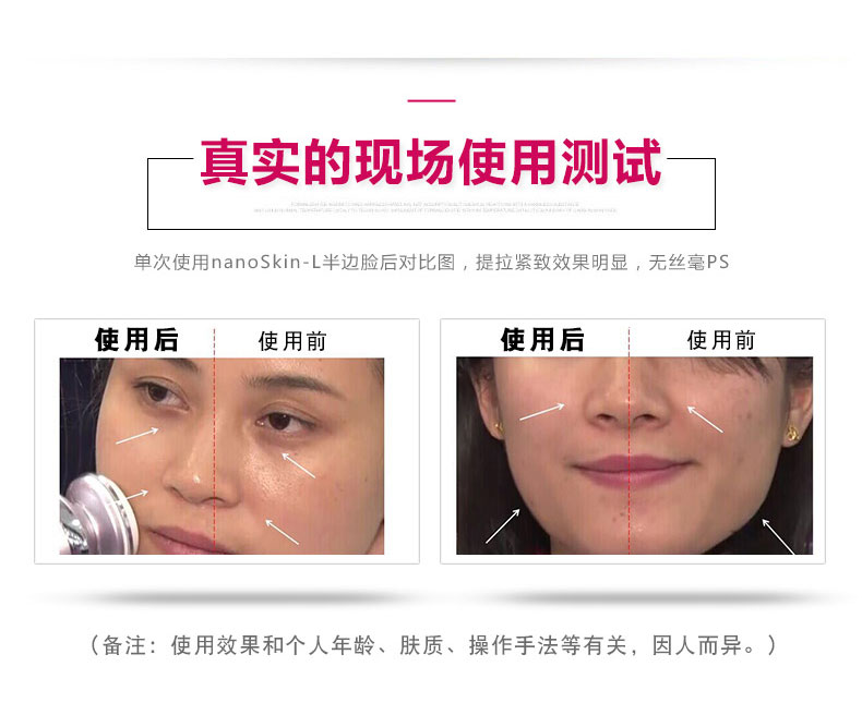 日本娜蜜絲導(dǎo)入美容儀器家用 臉部射頻嫩膚儀童顏機nanoSkin-L