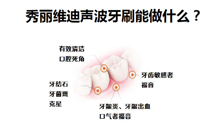秀麗維迪聲波牙刷（感應(yīng)式/干電池）成人聲波牙刷、兒童聲波牙刷